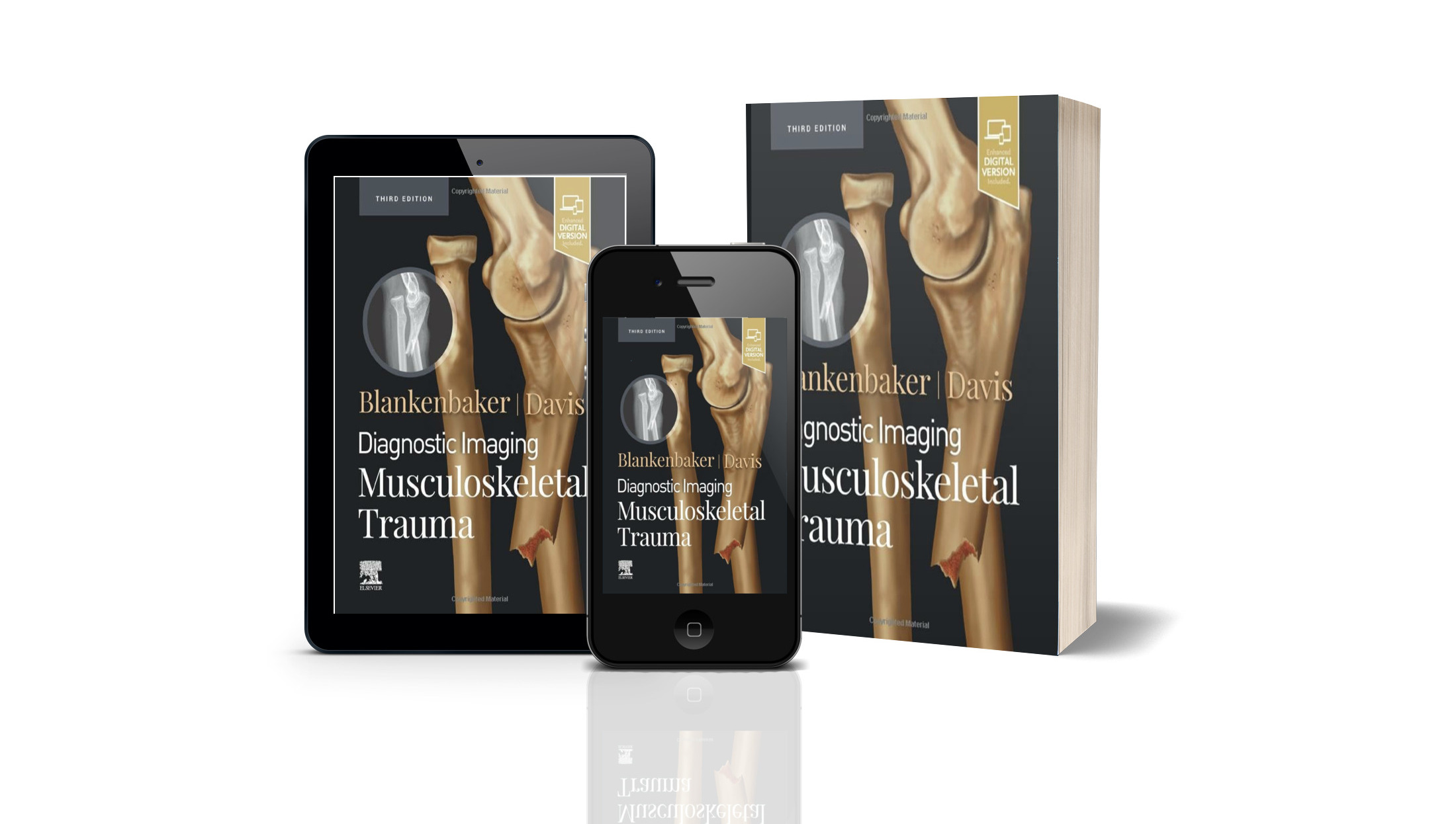 Diagnostic Imaging Musculoskeletal Trauma Rd Edition The Best